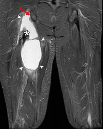 301 Moved Permanently