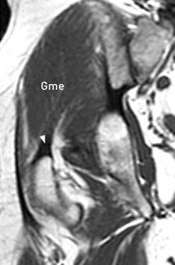 301 Moved Permanently